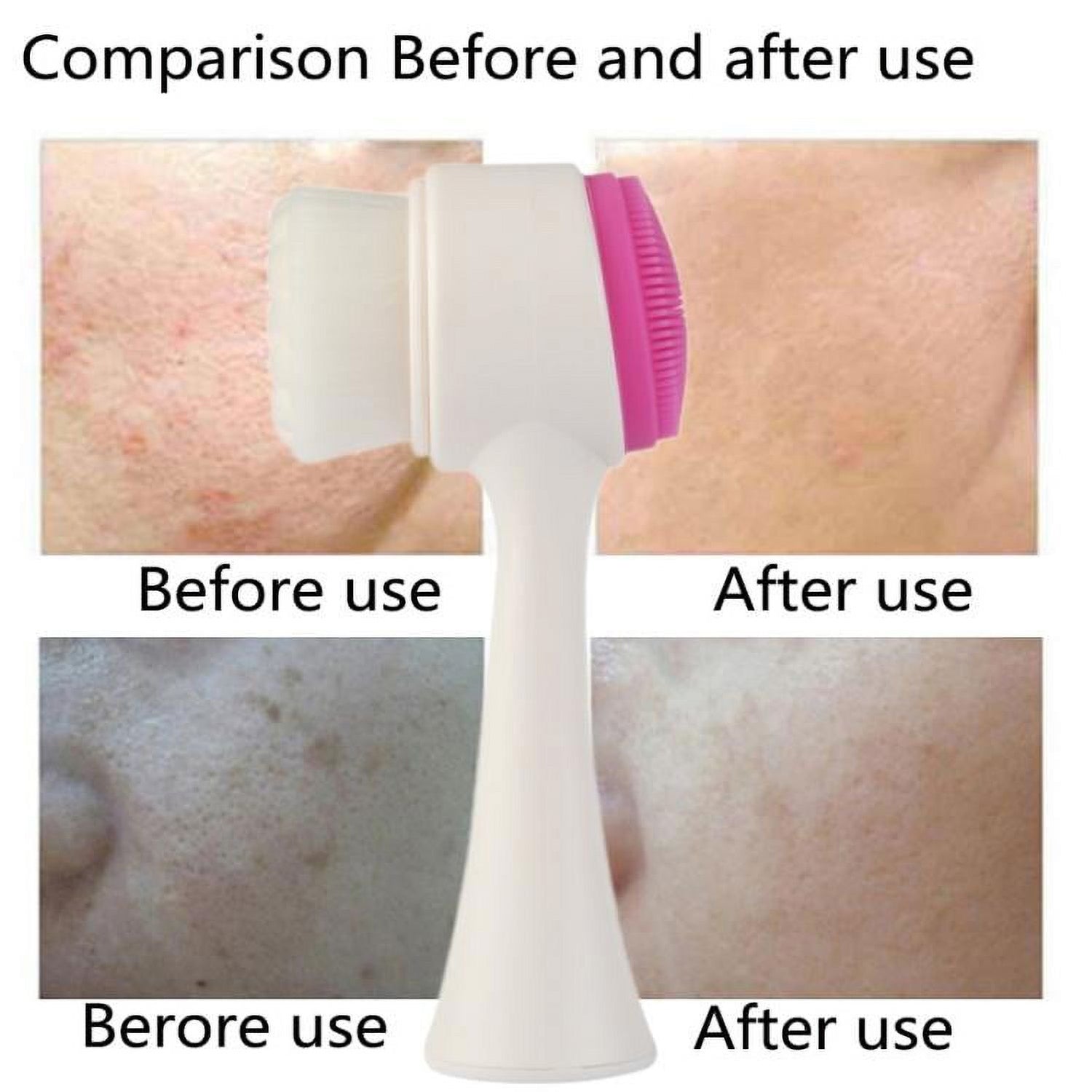 2 in 1 Facial Brush Cleansing Face Scrubber for Sensitive, Delicate, Dry Skin (1 Pc)